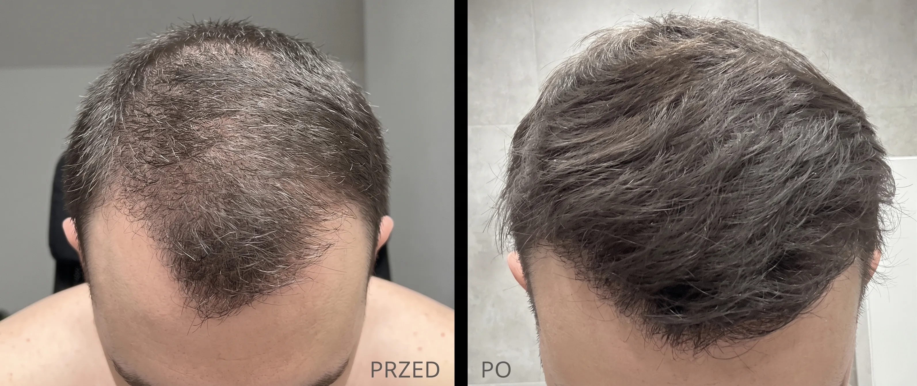 Przed i po 1,5 roku systemu
